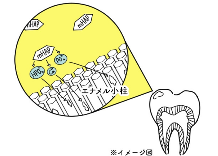 歯のトリートメント